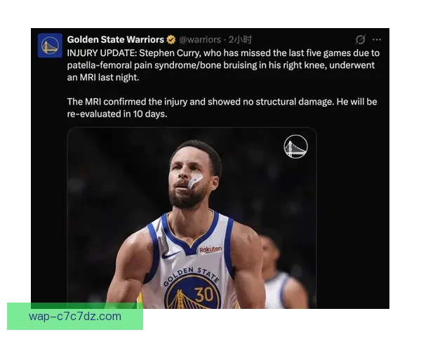 库里无缘本季评奖十日后查膝伤